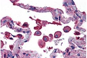 Human Lung: Formalin-Fixed, Paraffin-Embedded (FFPE) (TLR7 抗体  (AA 465-483))