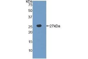 Detection of Recombinant TLR6, Human using Polyclonal Antibody to Toll Like Receptor 6 (TLR6) (TLR6 抗体  (AA 608-796))