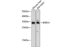 Western blot analysis of extracts of various cell lines using BPIFA1 Polyclonal Antibody at dilution of 1:1000. (BPIFA1 抗体)