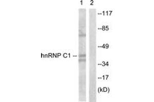 Western blot analysis of extracts from HuvEc cells, treated with EGF 200ng/ml 5', using hnRNP C1/2 (Ab-260) Antibody. (HNRNPC 抗体  (AA 231-280))