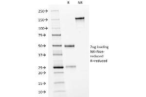 SDS-PAGE Analysis Purified HER-2 Mouse Monoclonal Antibody (HRB2/282). (ErbB2/Her2 抗体  (Extracellular Domain))
