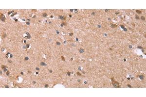 Immunohistochemistry of paraffin-embedded Human brain tissue using GPC6 Polyclonal Antibody at dilution 1:40 (Glypican 6 抗体)