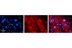 Rabbit Anti-MLX Antibody   Formalin Fixed Paraffin Embedded Tissue: Human heart Tissue Observed Staining: Cytoplasmic, nucleus Primary Antibody Concentration: 1:100 Other Working Concentrations: N/A Secondary Antibody: Donkey anti-Rabbit-Cy3 Secondary Antibody Concentration: 1:200 Magnification: 20X Exposure Time: 0. (MLX 抗体  (N-Term))