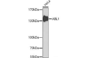 Western blot analysis of extracts of HeLa cells using ABL1 Polyclonal Antibody at dilution of 1:1000. (ABL1 抗体)