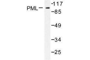 Image no. 1 for anti-Promyelocytic Leukemia (PML) antibody (ABIN271787) (PML 抗体)