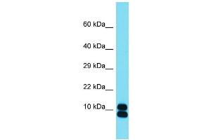 Host: Rabbit  Target Name: Rpl35  Sample Tissue: Mouse Small Intestine lysates  Antibody Dilution: 1. (RPL35 抗体  (Middle Region))