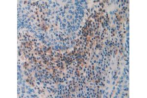 Used in DAB staining on fromalin fixed paraffin- embedded Kidney tissue (THBS3 抗体  (AA 670-921))