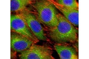 Fluorescent confocal image of C2C12 cells stained with AKT2 antibody at 1:25. (AKT2 抗体  (AA 416-444))