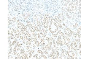 Immunohistochemistry (IHC) image for anti-Jun Dimerization Protein 2 (JDP2) (AA 50-100) antibody (ABIN7795635) (Recombinant JDP2 抗体  (AA 50-100))