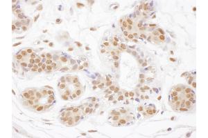 anti-Thymine-DNA Glycosylase (TDG) (AA 360-410) antibody