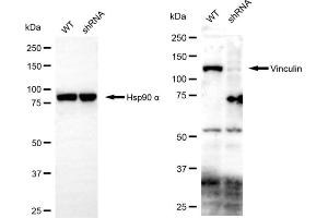 Western blotting analysis using vinculin antibody (ABIN7800841). (Vinculin 抗体)