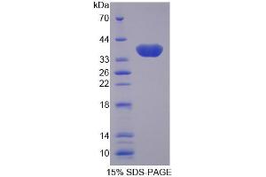 SDS-PAGE analysis of Pig GAL4 Protein. (GAL4 蛋白)