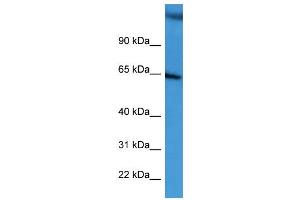 WB Suggested Anti-BCAM  Antibody Titration: 0. (BCAM 抗体  (C-Term))