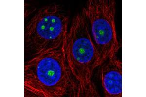 Immunofluorescent staining of MCF7 cells with NOP56 monoclonal antibody, clone CL2603  (Green) shows specific nucleoli.