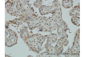 Image no. 1 for anti-Cullin-Associated and Neddylation-Dissociated 1 (CAND1) (AA 1-101) antibody (ABIN599270) (CAND1 抗体  (AA 1-101))