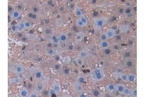 Detection of LCNL1 in Rat Liver Tissue using Polyclonal Antibody to Lipocalin Like Protein 1 (LCNL1) (LCNL1 抗体)