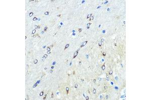 Immunohistochemistry of paraffin-embedded mouse brain using FUT4 Rabbit pAb (ABIN7267274) at dilution of 1:100 (40x lens). (CD15 抗体  (AA 200-300))