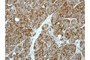 IHC-P Image Immunohistochemical analysis of paraffin-embedded SW480 xenograft, using MP1, antibody at 1:500 dilution. (MAPKSP1 抗体)