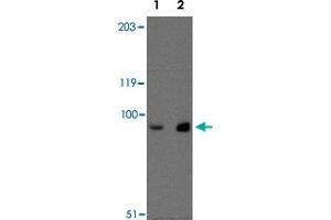 Western blot analysis of MEX3D in MDA-MB-361 cell lysate with MEX3D polyclonal antibody  at (Lane 1) 1 ug/mL and (Lane 2) 2 ug/mL . (MEX3D 抗体  (Internal Region))