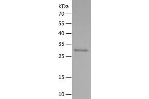 SLC34A2 Protein (AA 1-100) (His-IF2DI Tag)