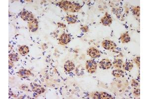 Formalin-fixed and paraffin embedded human kidney labeled with Anti-PBEF1 Polyclonal Antibody, Unconjugated  at 1:200 followed by conjugation to the secondary antibody and DAB staining. (NAMPT 抗体  (AA 301-400))