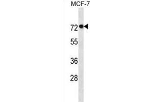 AG Antibody (N-term) (ABIN1881050 and ABIN2838685) western blot analysis in MCF-7 cell line lysates (35 μg/lane). (AGAP11 抗体  (N-Term))
