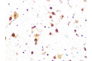 Immunohistochemistry of paraffin-embedded mouse spinal cord using Casein Kinase 2 beta (CSNK2B) (CSNK2B) Rabbit mAb (ABIN1680593, ABIN3019007, ABIN3019008 and ABIN7101698) at dilution of 1:100 (40x lens). (CSNK2B 抗体)