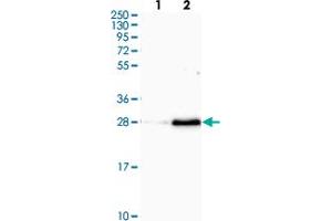 Western blot analysis of Lane 1: Human cell line RT-4 Lane 2: Human cell line U-251MG sp with OIP5 polyclonal antibody  at 1:100-1:250 dilution. (OIP5 抗体)