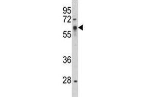 Western Blotting (WB) image for anti-Proto-oncogene tyrosine-protein kinase Src (Src) (AA 397-424) antibody (ABIN3029553)