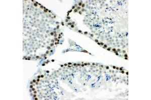 Anti- MCM7 Picoband antibody,IHC(P) IHC(P): Mouse Testis Tissue