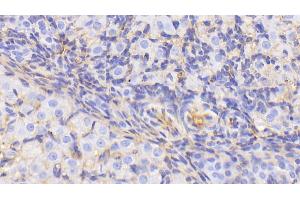 Immunohistochemistry (IHC) image for anti-Albumin (ALB) antibody (ABIN7429670)