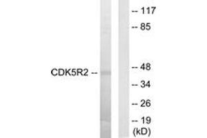 Western blot analysis of extracts from HuvEc cells, using CDK5R2 Antibody.