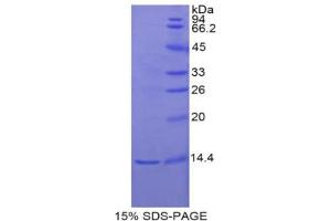 SDS-PAGE analysis of Rat Inhibin beta E Protein. (INHBE 蛋白)