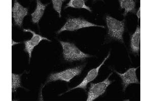 Immunofluorescent staining of HeLa (ATCC CCL-2) cells. (GRB2 抗体  (AA 1-217))