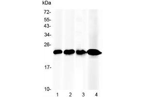 Western blot testing of 1) mouse liver, 2) rat liver, 3) human placenta and 4) human HepG2 lysate with RBP4 antibody at 0. (RBP4 抗体)
