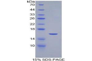 SDS-PAGE analysis of Mouse NRARP Protein. (NRARP 蛋白)