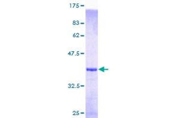 MEF2BNB Protein (AA 1-119) (GST tag)