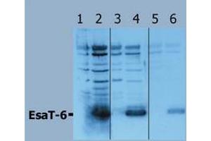 Western Blotting (Mycobacterium Tuberculosis Antigen EsaT-6 (Rv3875) 抗体)