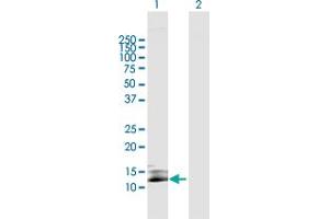 Western Blot analysis of SIVA1 expression in transfected 293T cell line by SIVA1 MaxPab polyclonal antibody.