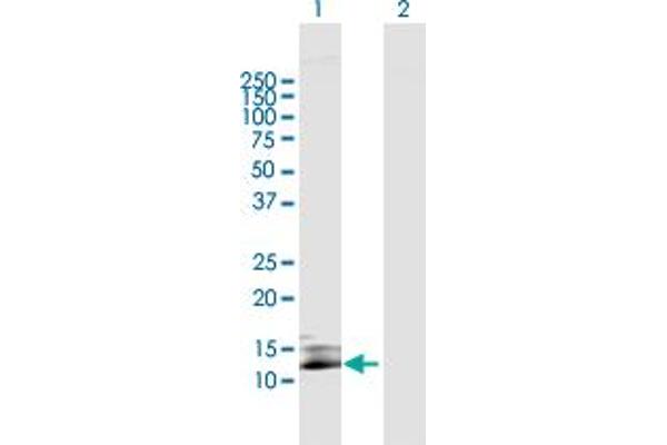 SIVA1 anticorps  (AA 1-110)