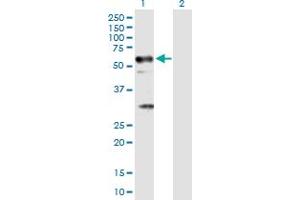 Western Blot analysis of TRAF6 expression in transfected 293T cell line by TRAF6 MaxPab polyclonal antibody. (TRAF6 抗体  (AA 1-522))