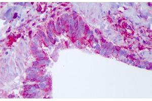 Human Lung: Formalin-Fixed, Paraffin-Embedded (FFPE) (NLRP11 抗体  (C-Term))