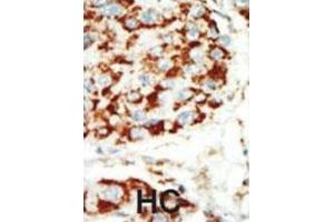 Immunohistochemistry (IHC) image for anti-Protein Kinase, AMP-Activated, beta 1 Non-Catalytic Subunit (PRKAB1) antibody (ABIN3002958) (PRKAB1 抗体)