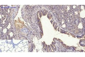 Immunohistochemistry of paraffin-embedded Rat lung tissue using GLUT-4 Polyclonal Antibody at dilution of 1:200. (GLUT4 抗体)