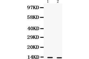 Observed bind size: 13KD (S100A9 抗体  (AA 2-114))