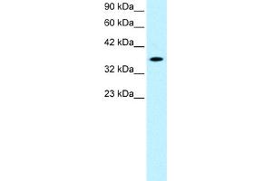 WB Suggested Anti-RAX Antibody Titration:  0. (RAX 抗体  (N-Term))