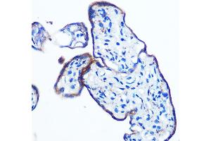 Immunohistochemistry of paraffin-embedded human placenta using IKKε Rabbit mAb (ABIN7267875) at dilution of 1:100 (40x lens). (IKKi/IKKe 抗体)