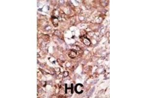 Immunohistochemistry (IHC) image for anti-BCL2-Associated Agonist of Cell Death (BAD) (BH3 Domain) antibody (ABIN2997223)