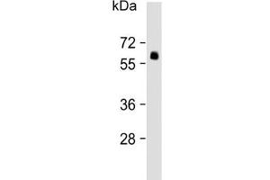 Western blot testing of human lung lysate with SMAD6 antibody. (SMAD6 抗体  (AA 358-386))