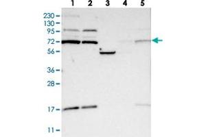 Western blot analysis of Lane 1: RT-4, Lane 2: U-251 MG, Lane 3: Human Plasma, Lane 4: Liver, Lane 5: Tonsil with KLHL6 polyclonal antibody .